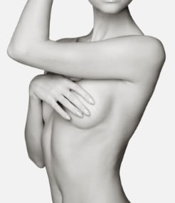 Breast augmentation in Sydney, model 02-3, Dr Bish Soliman Plastic Surgeon
