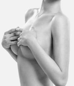 Breast implant removal surgery, model 02, Soliman Plastic Surgery Sydney